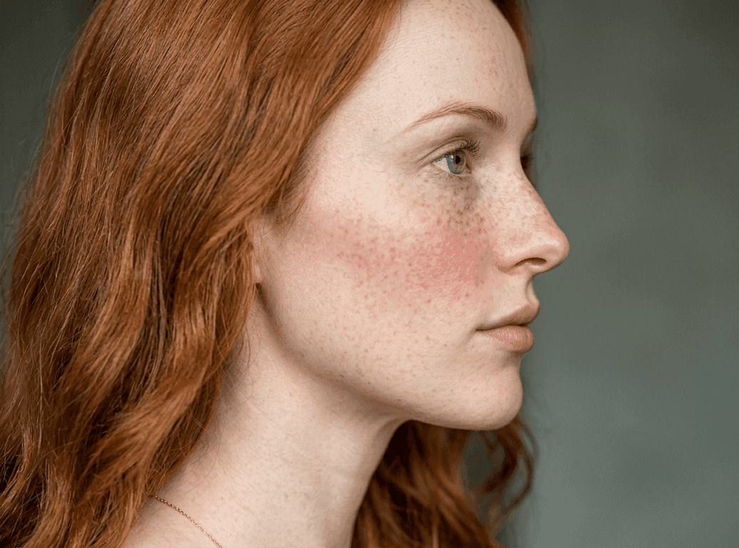Example photo: Face — profile — Direct side view showing jawline and hairline.