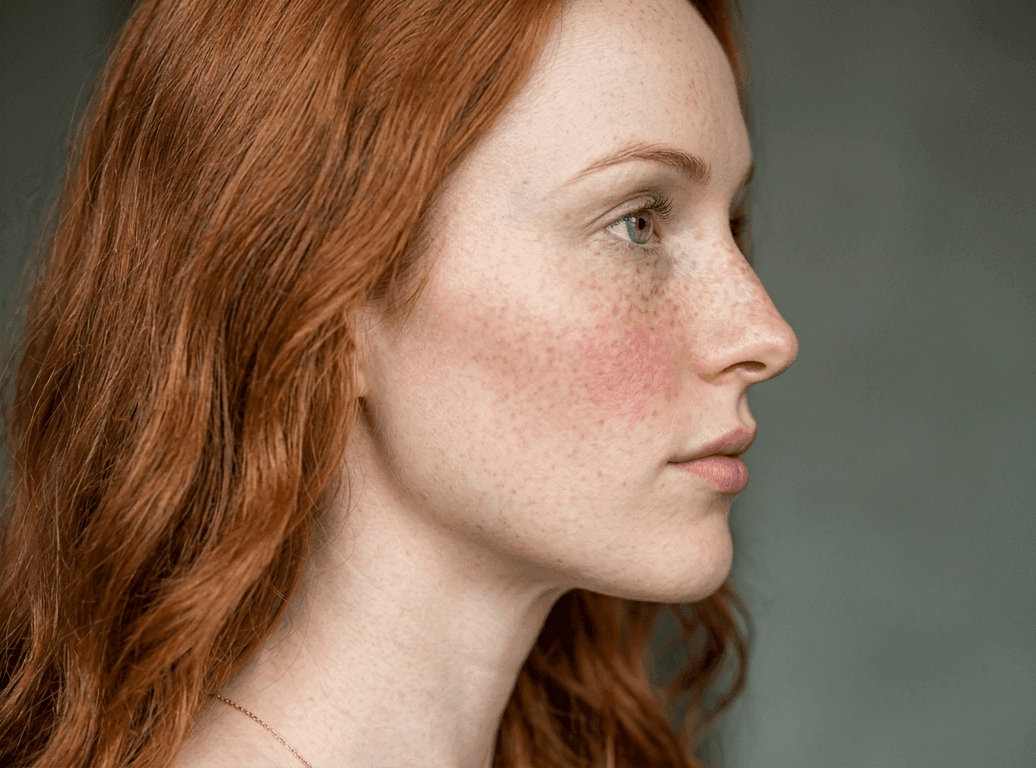 Example photo: Face — profile — Direct side view showing jawline and hairline.